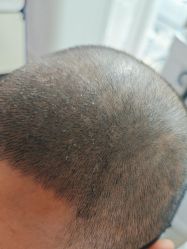 -雍禾植发全国连锁