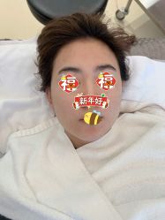 体验后-恒妍医美·韩国定制抗衰中心