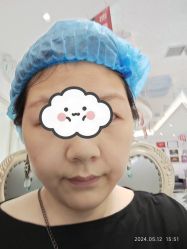 体验前-武汉颜范薇美医疗美容门诊部