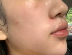 -上海漾颜医疗美容