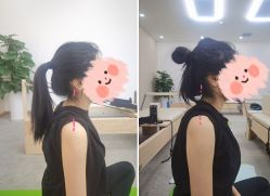 -卓拓普拉提
