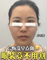 -天津健丽·去眼袋医疗美容机构