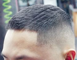 -大麦微针植发丨全国连锁