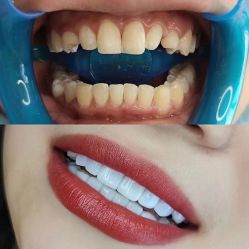 -美朵纹绣美牙纹眉工作室