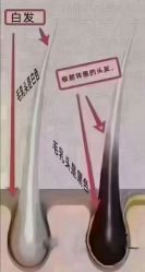 点击看大图 -诗碧曼养发