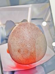 体验后-大麦微针植发全国连锁