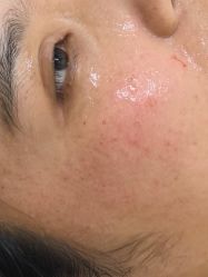 -长沙雅美医疗美容医院