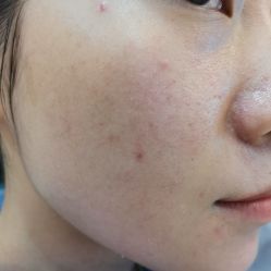 -丽美妍医疗美容·皮秒·立体分层抗衰