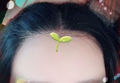-大麦微针植发全国连锁