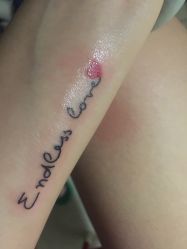 点击看大图 -新肤洗纹身