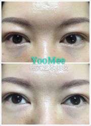 -YooMee优美智能科技美肤机构