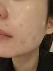 体验后-和颜一美轻医美连锁