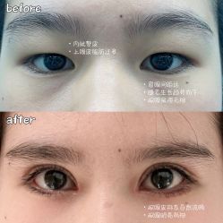 -素美医疗美容·西南眼鼻整形·修复基地