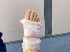 -Andrew指甲专科灰指甲·甲沟炎矫正·3D步态矫形鞋垫定制(上海法华镇路旗舰店)
