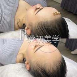 -RC半永久纹眉纹发际线