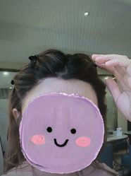 -碧莲盛·不剃发植发