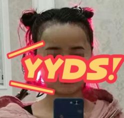 -大麦微针植发丨全国连锁