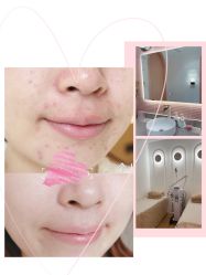 -苗方清颜痘肌研究所