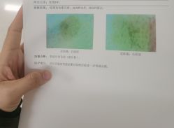 -皮肤激光医学中心