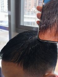 -碧莲盛·不剃发植发