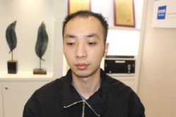 -大麦微针植发丨全国连锁