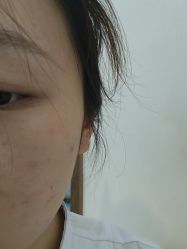 -长沙雅美医疗美容医院