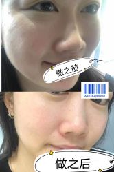 -海菲秀·飞顿牛奶光·LDM官方授权中心美轮美浣瓷感美肌