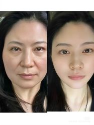 -安吉拉青春化管理中心