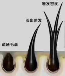-诗碧曼养发