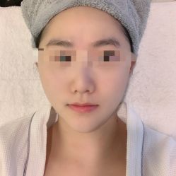 -溢美古法抗衰