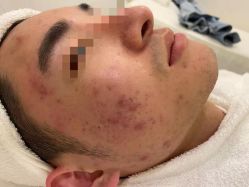 -友仟痘医生科学祛痘连锁