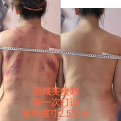 -丽减美瘦吧·减肥瘦身