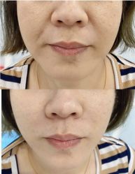 -云南吴氏嘉美医疗美容医院