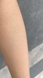 体验前-美莱医学美容医院