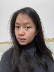 -成都西区医院整形美容