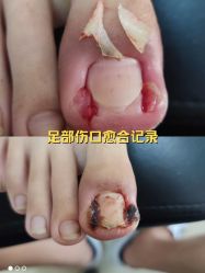 点击看大图 -爱足康修脚·甲沟炎·艾灸养生馆