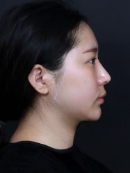 体验后-南宁华美医疗美容医院