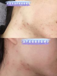 -四川娇点医学美容医院