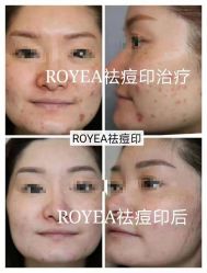 -ROYEA茹彦祛痘·问题肌肤修护中心