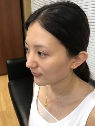-南宁维密整形·王敦华眼鼻整复中心