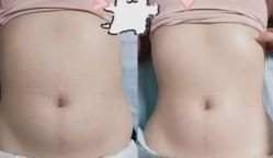-Lily纤美·科技减脂中心