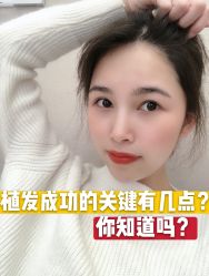 -大麦微针植发全国连锁