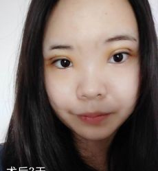 -广州健丽·去眼袋医疗美容机构