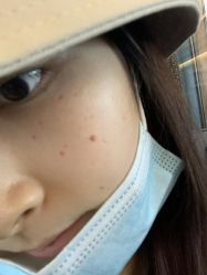 -铂特丽医美·眼鼻整形·光电美肤·注射抗衰