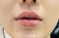 -东剑医学美容·注射美学中心