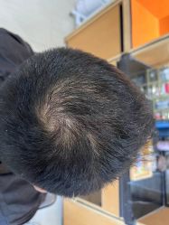 -雍禾植发
