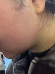 -四川米兰柏羽医学美容医院