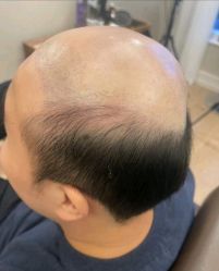 -乐绅男士高端假发定制