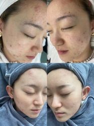 点击看大图 -苗方清颜痘肌研究所