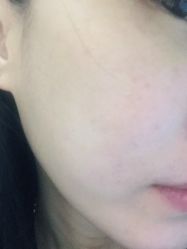 体验后-联合丽格·张菡丽格医疗美容